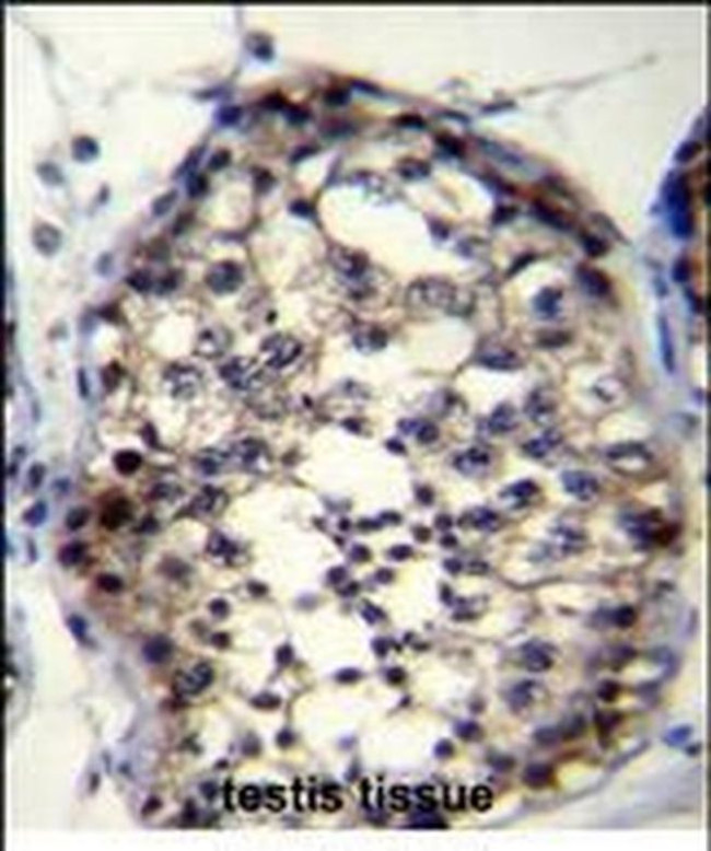 ROPN1L Antibody in Immunohistochemistry (Paraffin) (IHC (P))