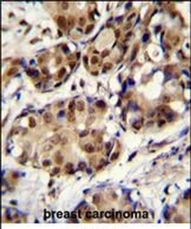 MNAR Antibody in Immunohistochemistry (Paraffin) (IHC (P))