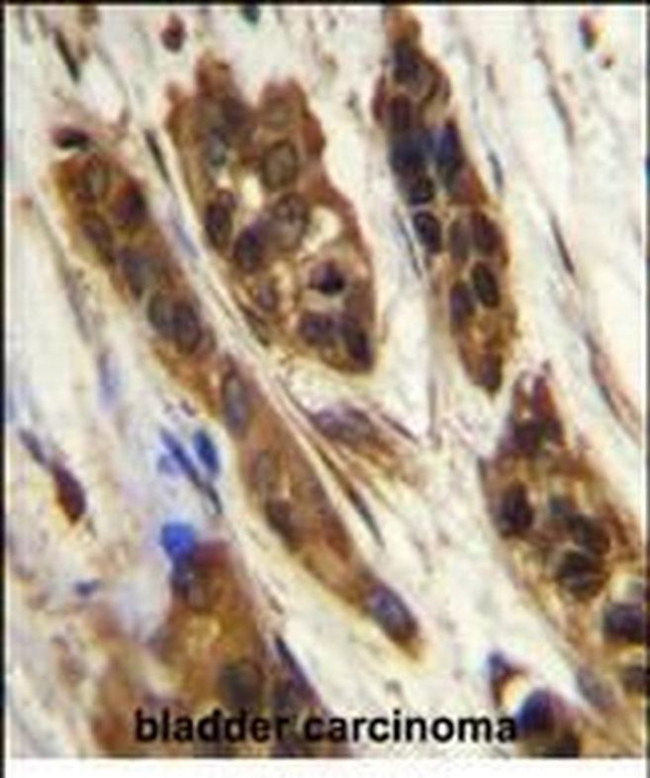 SNRNP27 Antibody in Immunohistochemistry (Paraffin) (IHC (P))
