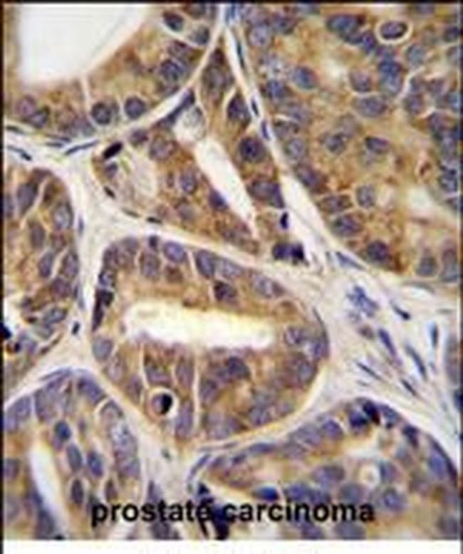 RNF215 Antibody in Immunohistochemistry (Paraffin) (IHC (P))