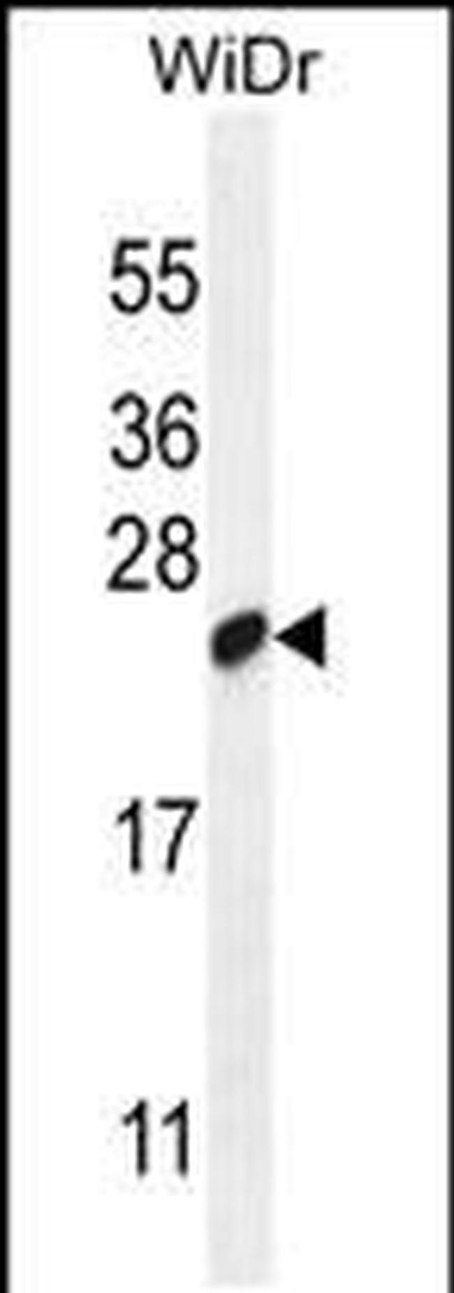 C19orf84 Antibody in Western Blot (WB)