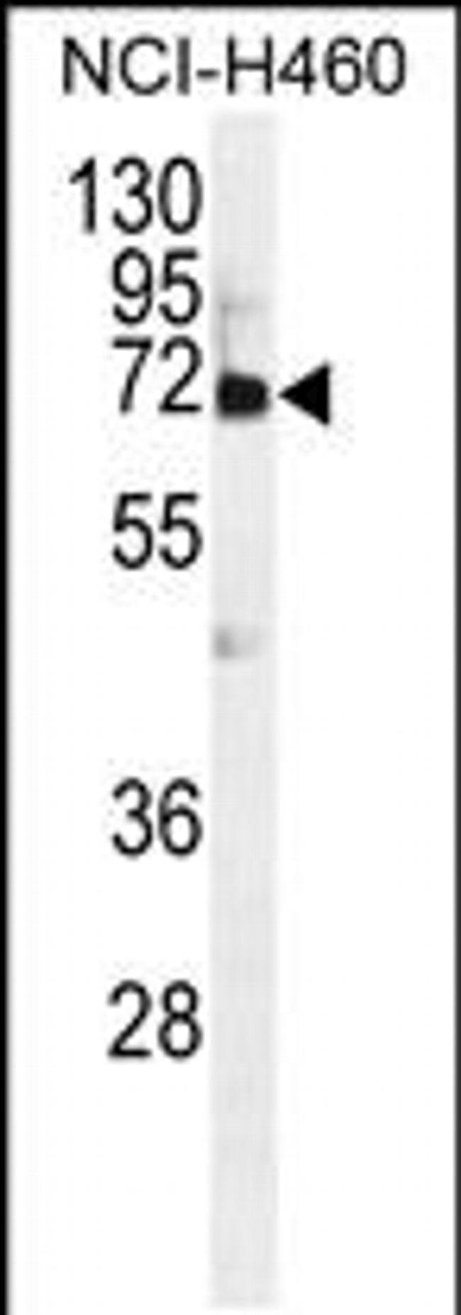 VWA2 Antibody in Western Blot (WB)