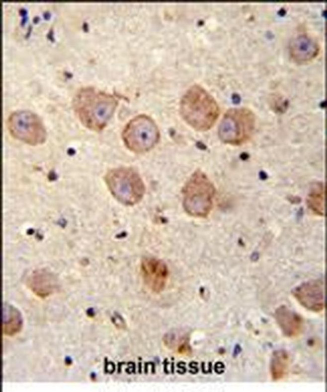 SKOR2 Antibody in Immunohistochemistry (Paraffin) (IHC (P))