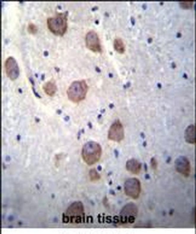 RGS7 Antibody in Immunohistochemistry (Paraffin) (IHC (P))