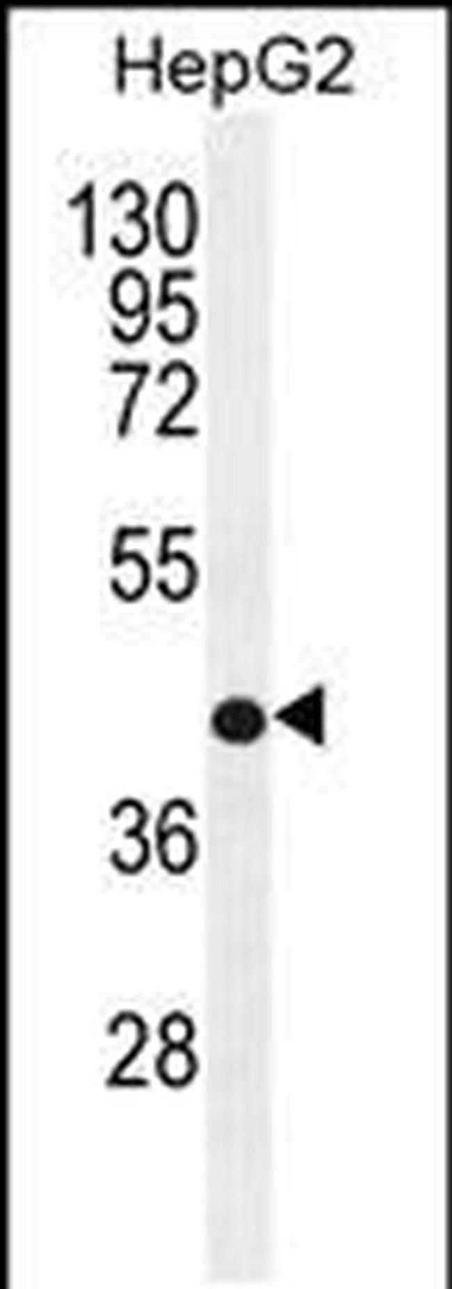 RDH13 Antibody in Western Blot (WB)