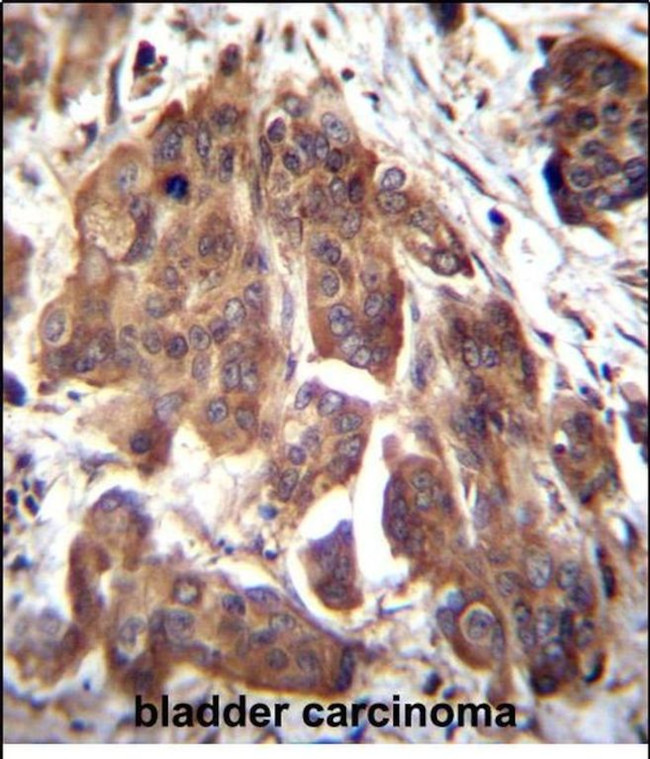 GLMN Antibody in Immunohistochemistry (Paraffin) (IHC (P))