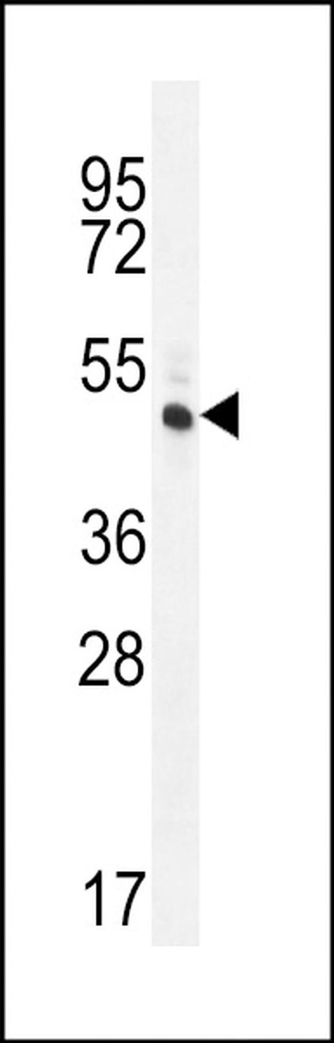 RINL Antibody in Western Blot (WB)