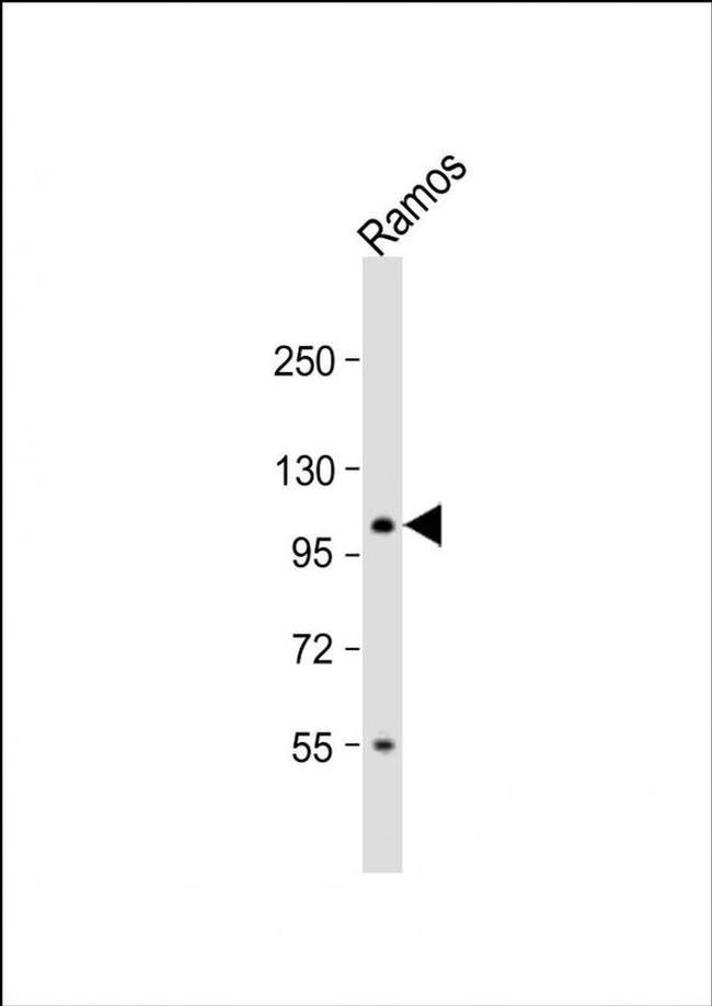TAF4B Antibody in Western Blot (WB)