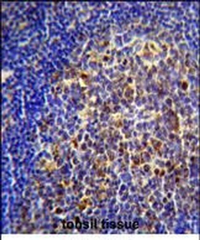 CHRNA10 Antibody in Immunohistochemistry (Paraffin) (IHC (P))