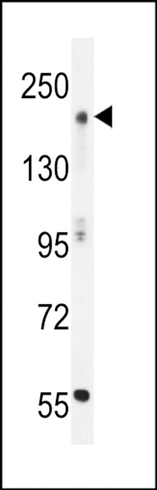 MOZ Antibody in Western Blot (WB)