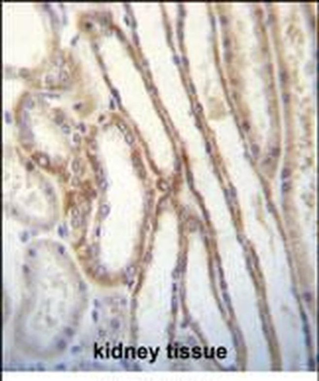 MYO3B Antibody in Immunohistochemistry (Paraffin) (IHC (P))