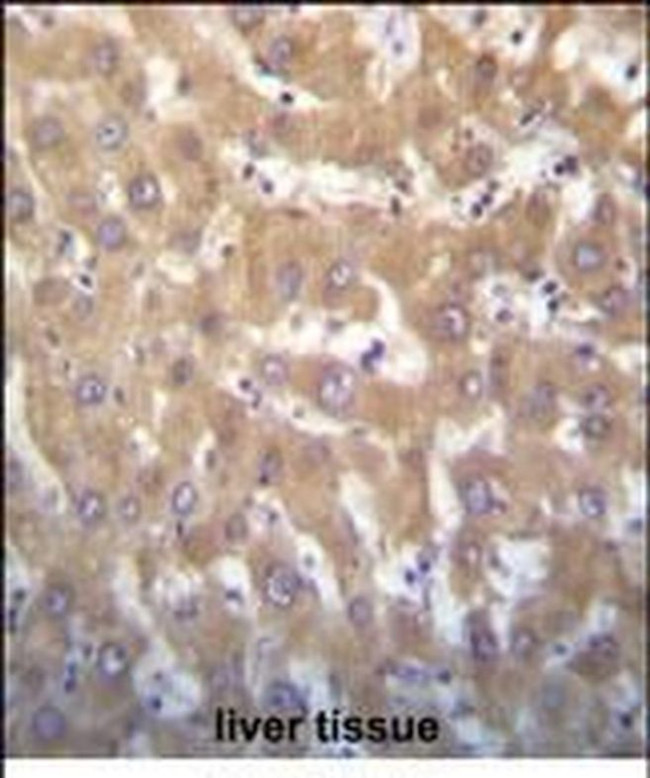KDM5A Antibody in Immunohistochemistry (Paraffin) (IHC (P))