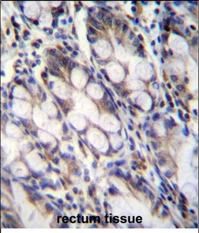 FNDC7 Antibody in Immunohistochemistry (Paraffin) (IHC (P))