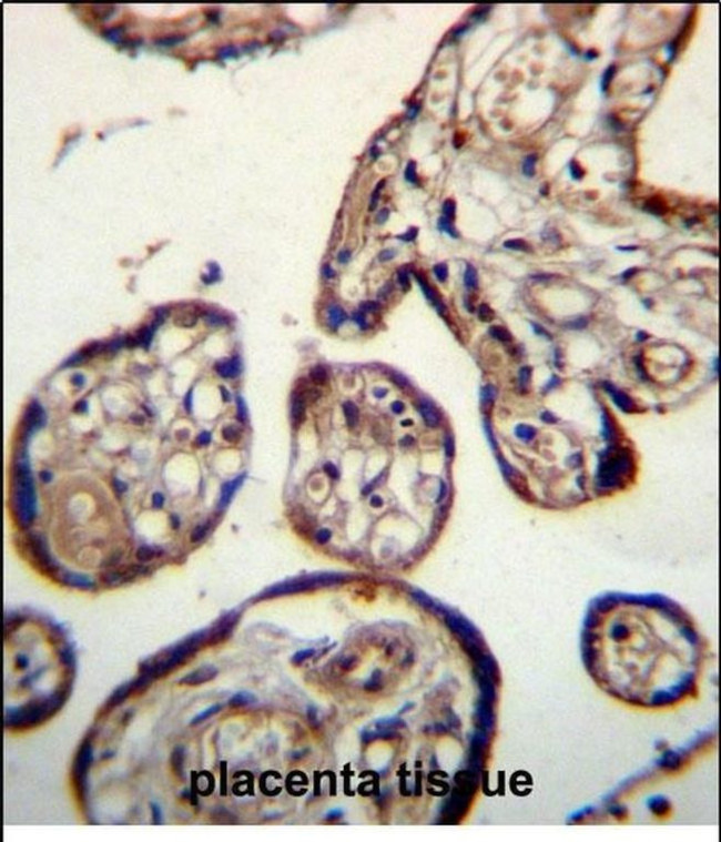Calumenin Antibody in Immunohistochemistry (Paraffin) (IHC (P))