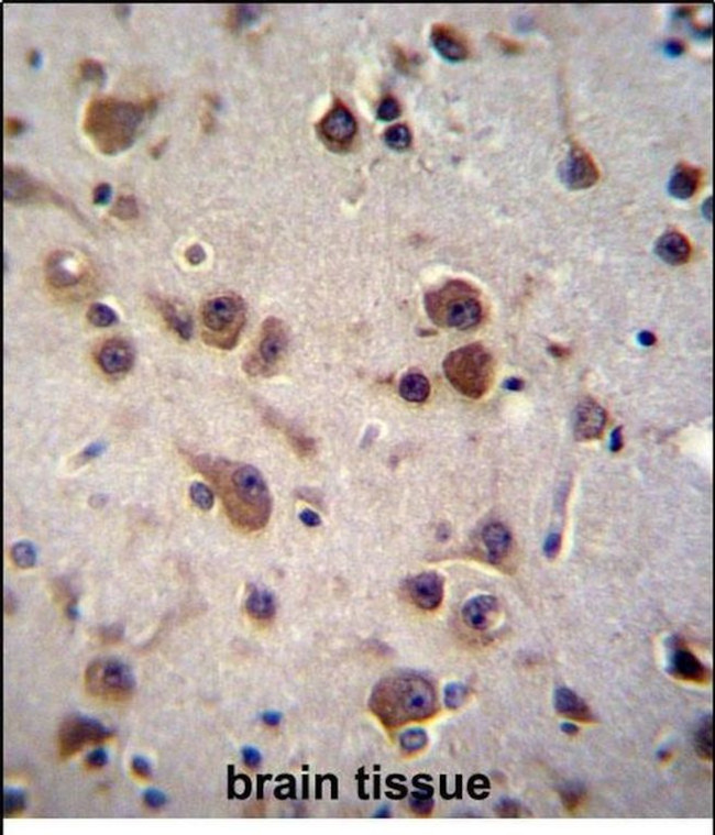 CHST6 Antibody in Immunohistochemistry (Paraffin) (IHC (P))