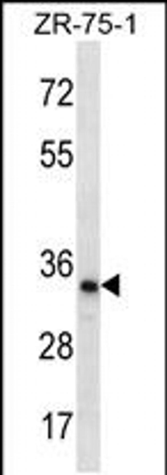 TLCD2 Antibody in Western Blot (WB)