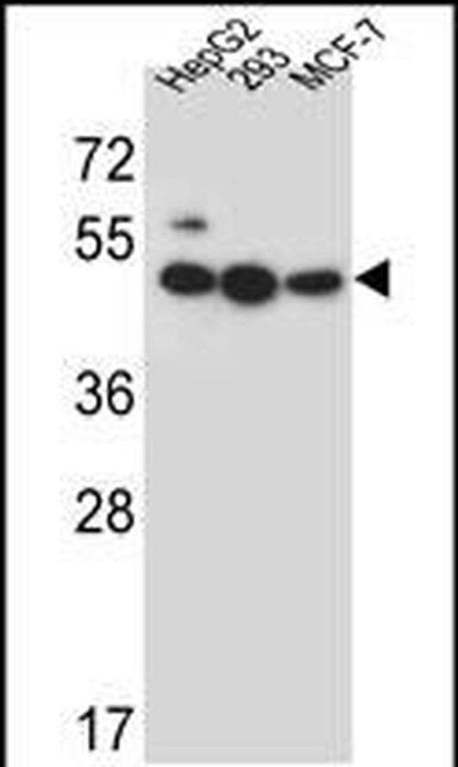 LIPJ Antibody in Western Blot (WB)