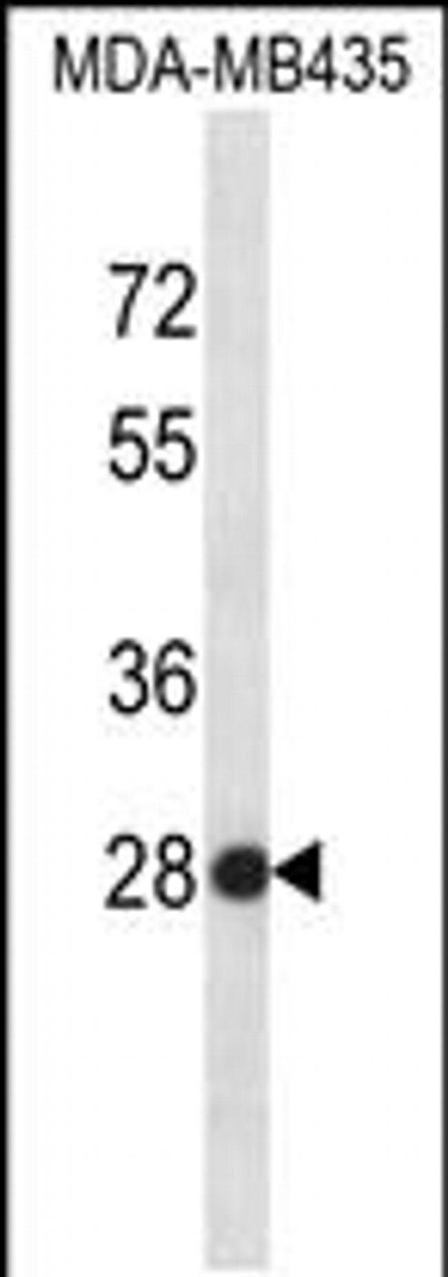 SNRPB2 Antibody in Western Blot (WB)