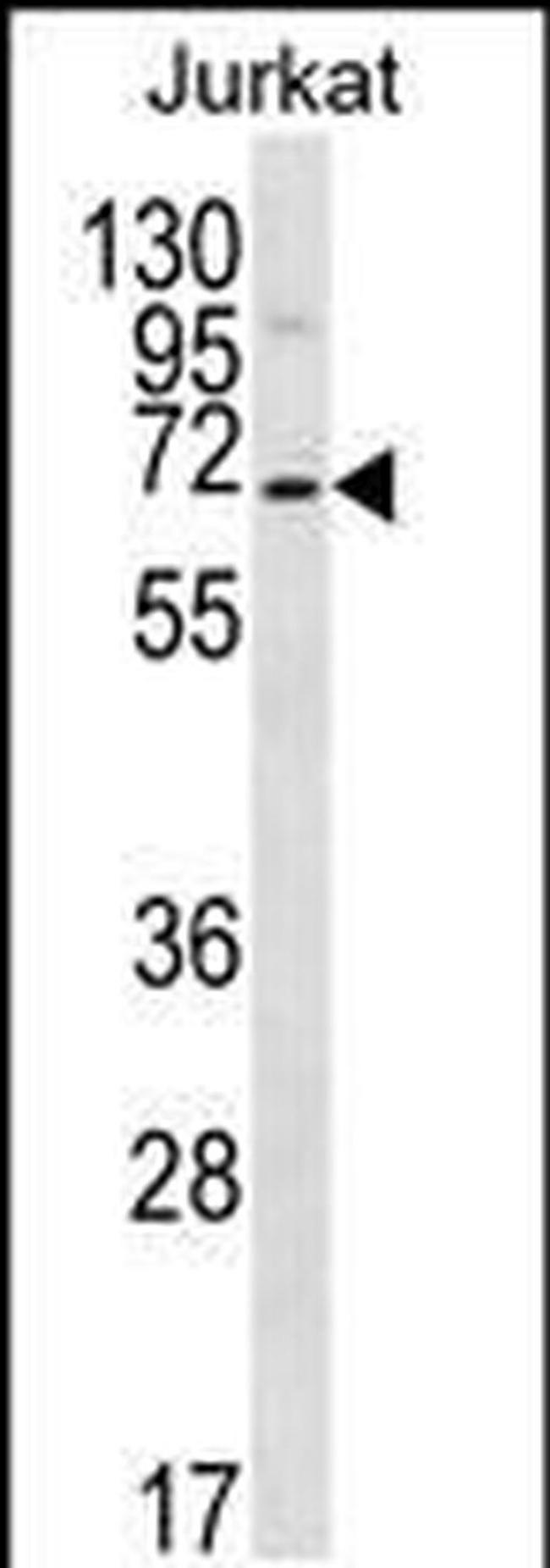 PSAPL1 Antibody in Western Blot (WB)
