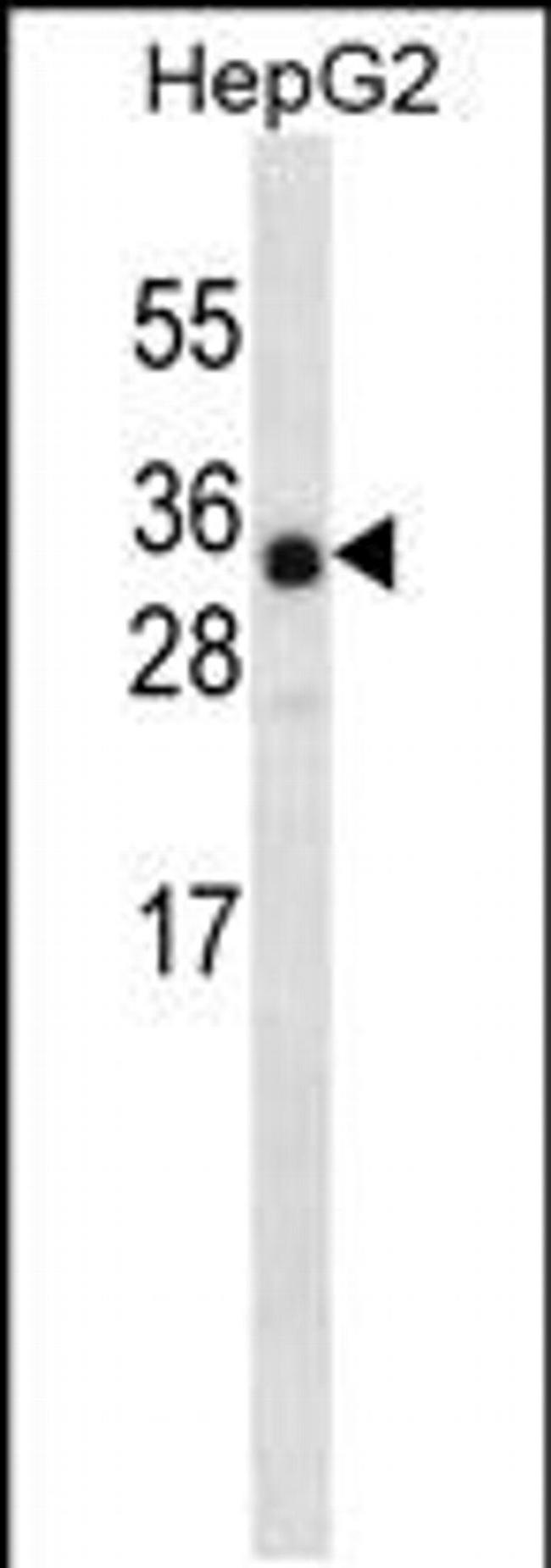 ANKRD46 Antibody in Western Blot (WB)