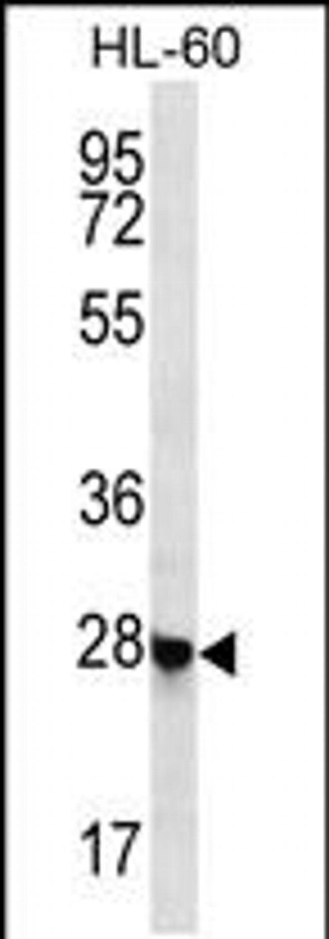 RITA1 Antibody in Western Blot (WB)
