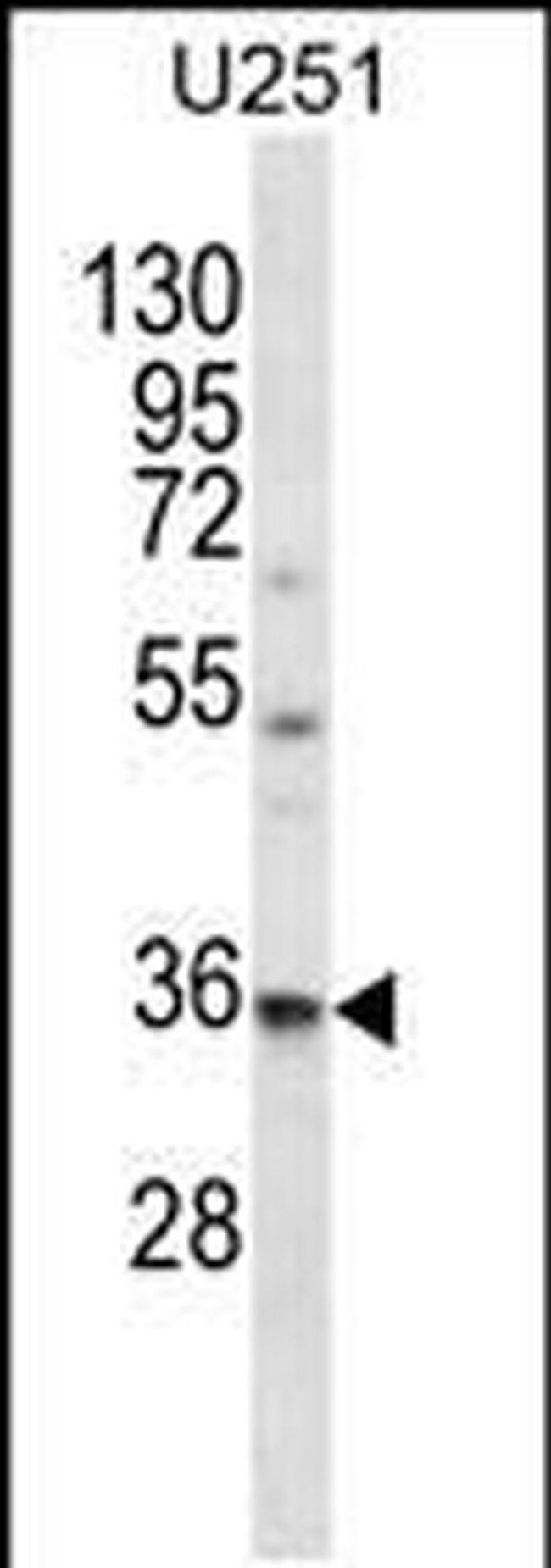 VPS37B Antibody in Western Blot (WB)
