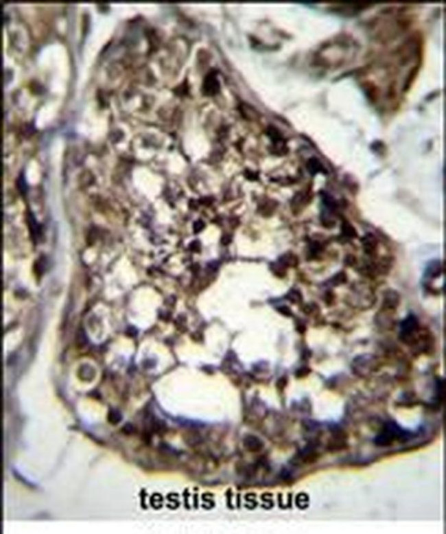 TBCEL Antibody in Immunohistochemistry (Paraffin) (IHC (P))