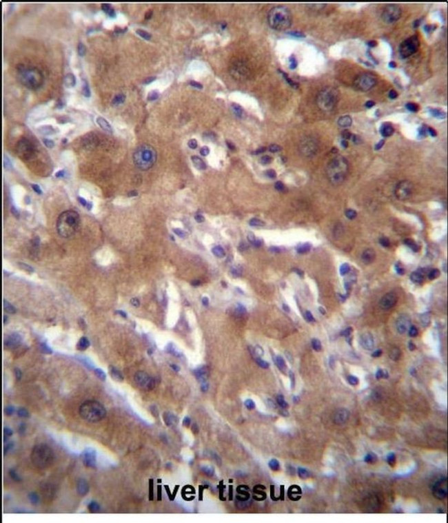 RASSF10 Antibody in Immunohistochemistry (Paraffin) (IHC (P))
