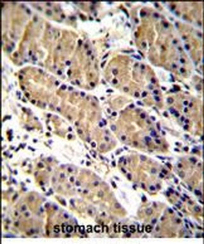 WFDC1 Antibody in Immunohistochemistry (Paraffin) (IHC (P))