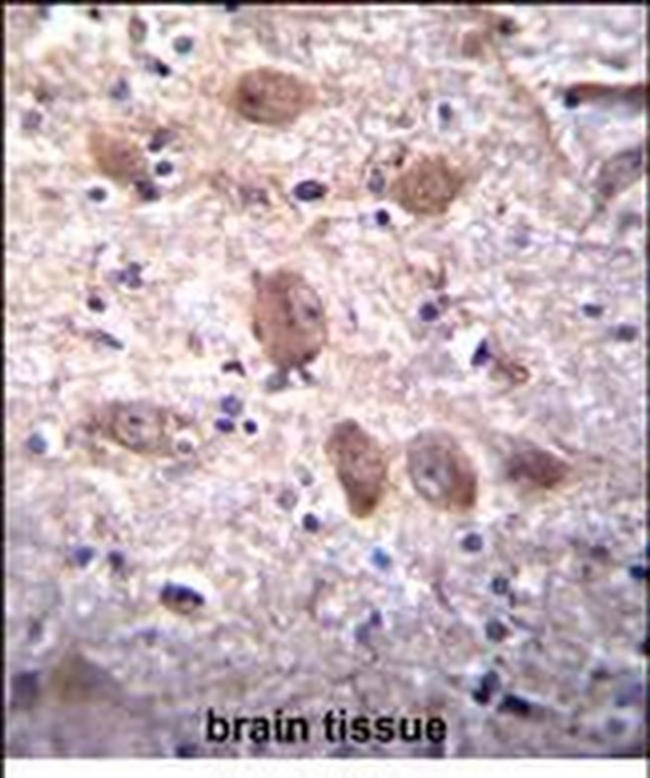 SPG7 Antibody in Immunohistochemistry (Paraffin) (IHC (P))
