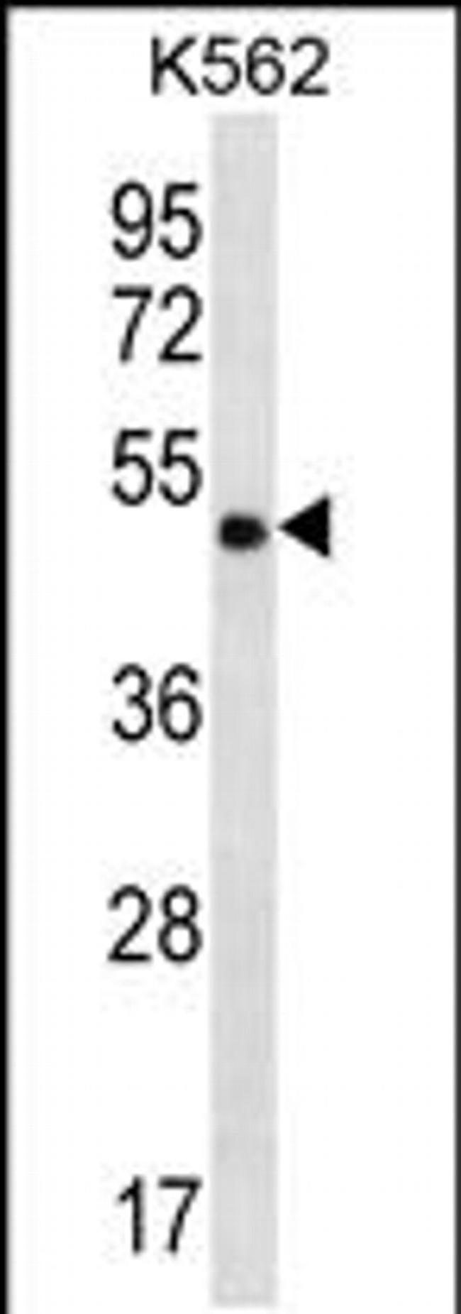 CCDC71 Antibody in Western Blot (WB)