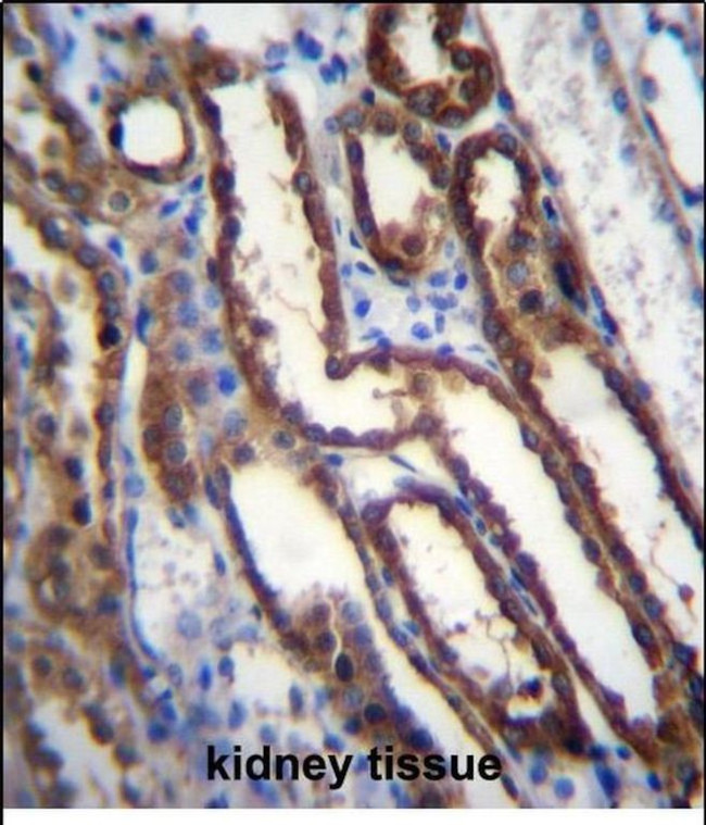 NXN Antibody in Immunohistochemistry (Paraffin) (IHC (P))