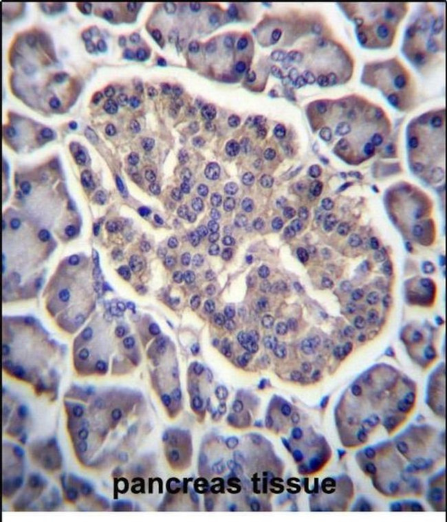 GPD2 Antibody in Immunohistochemistry (Paraffin) (IHC (P))