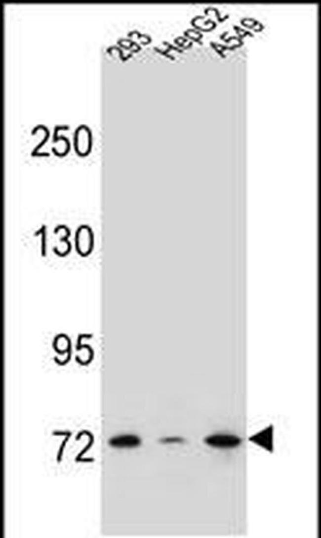ZNF569 Antibody in Western Blot (WB)