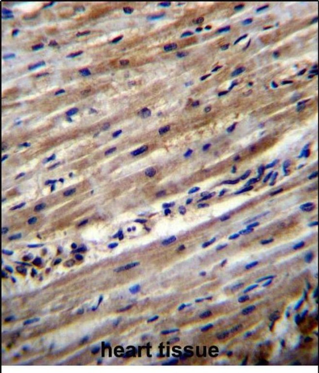 DUS1L Antibody in Immunohistochemistry (Paraffin) (IHC (P))