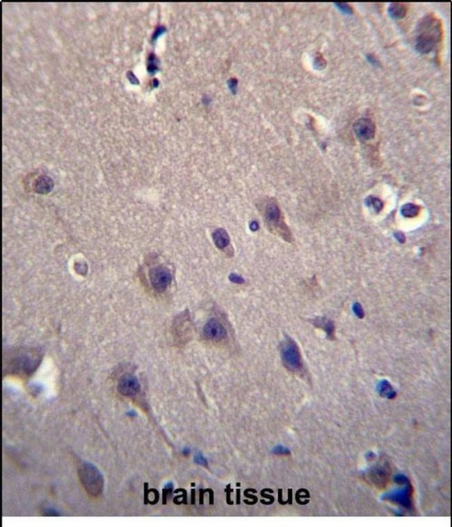 MCF2 Antibody in Immunohistochemistry (Paraffin) (IHC (P))