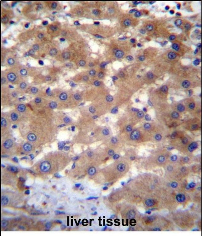 UBE2NL Antibody in Immunohistochemistry (Paraffin) (IHC (P))
