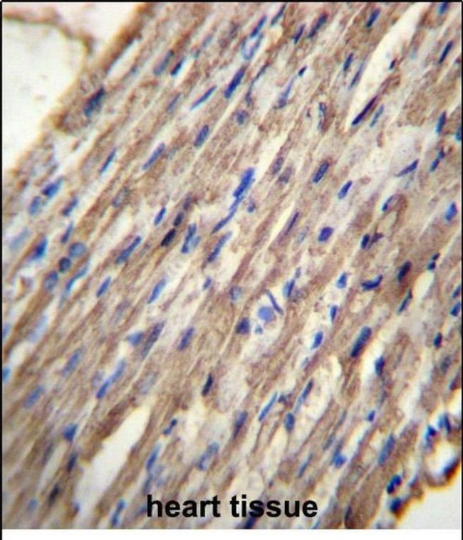 ACSM6 Antibody in Immunohistochemistry (Paraffin) (IHC (P))