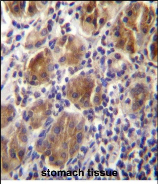 Melanophilin Antibody in Immunohistochemistry (Paraffin) (IHC (P))