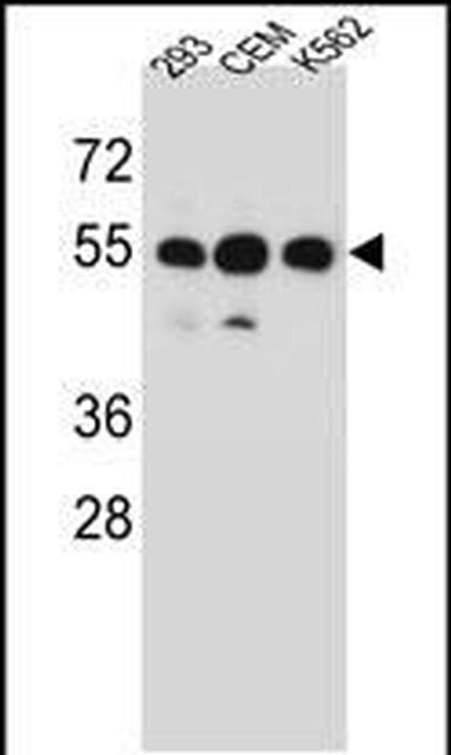 ZNF562 Antibody in Western Blot (WB)