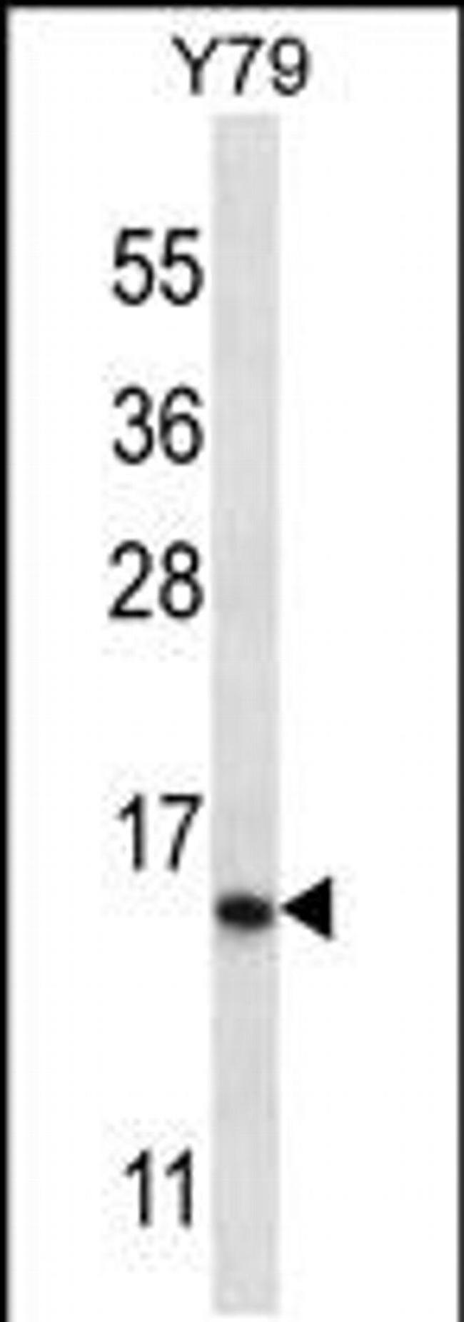 NR2C2AP Antibody in Western Blot (WB)