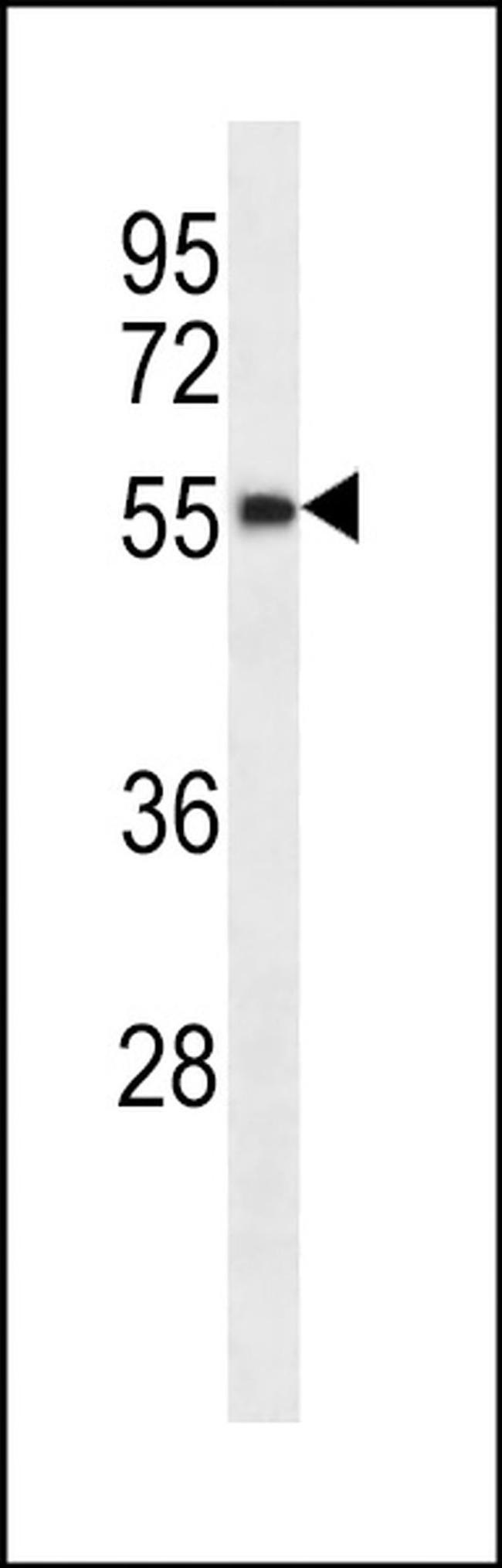 RBM48 Antibody in Western Blot (WB)