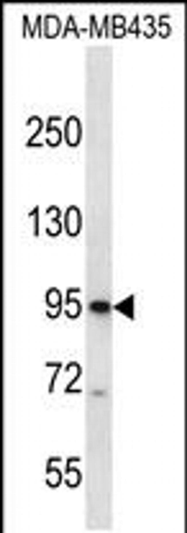 CNGB3 Antibody in Western Blot (WB)