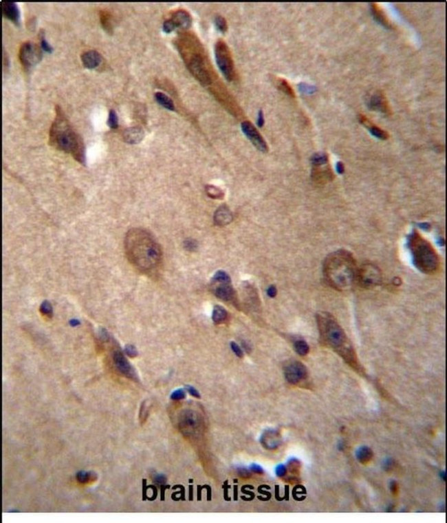 RIC3 Antibody in Immunohistochemistry (Paraffin) (IHC (P))