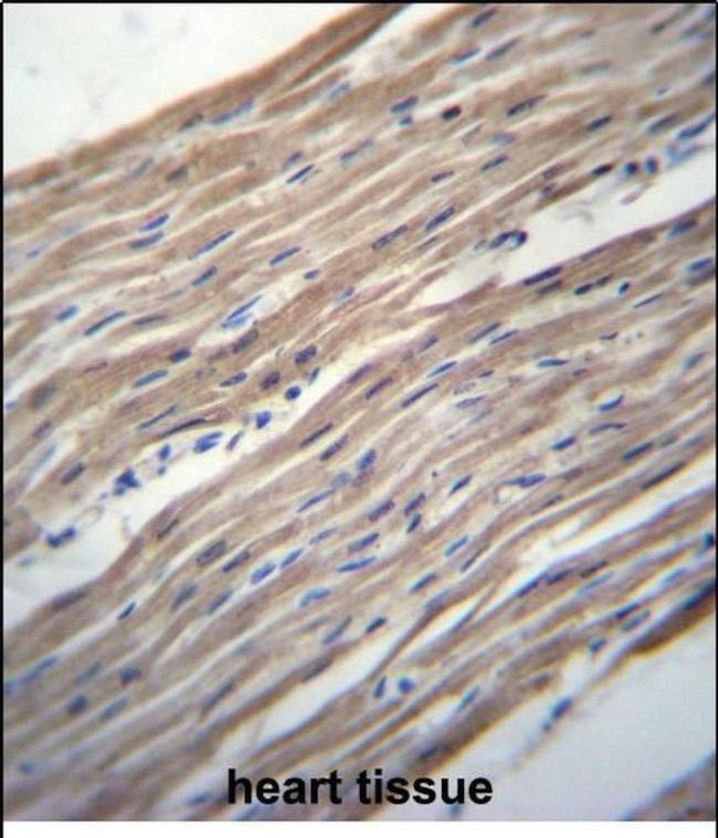HRC Antibody in Immunohistochemistry (Paraffin) (IHC (P))