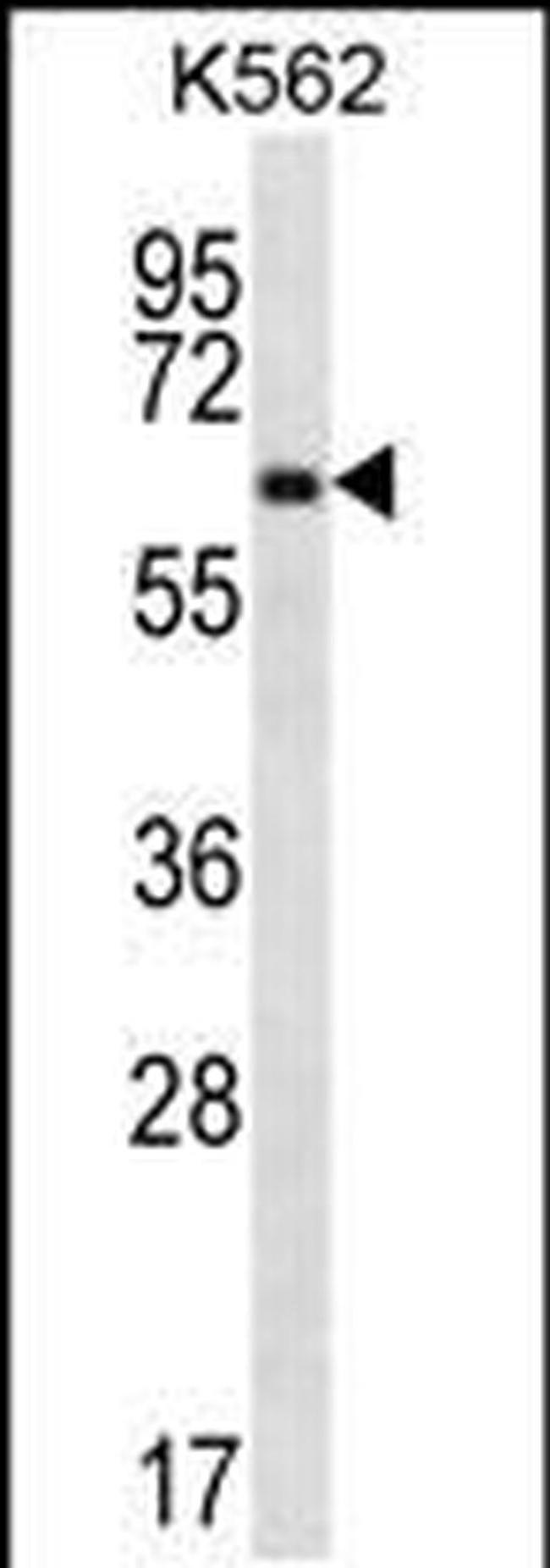 ZNF623 Antibody in Western Blot (WB)