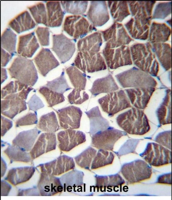 NPHP3 Antibody in Immunohistochemistry (Paraffin) (IHC (P))