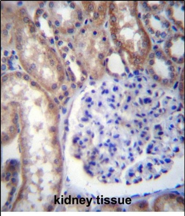GNA14 Antibody in Immunohistochemistry (Paraffin) (IHC (P))
