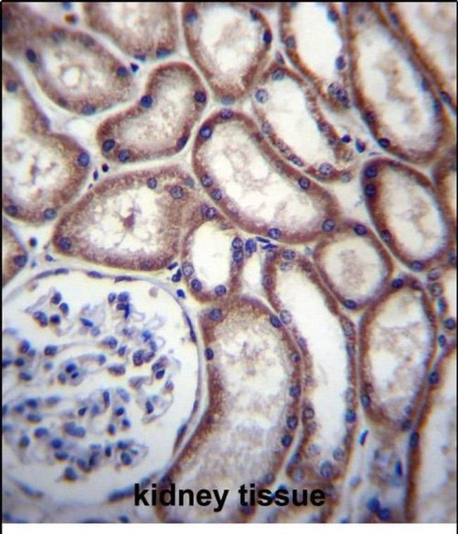 DNAJC27 Antibody in Immunohistochemistry (Paraffin) (IHC (P))
