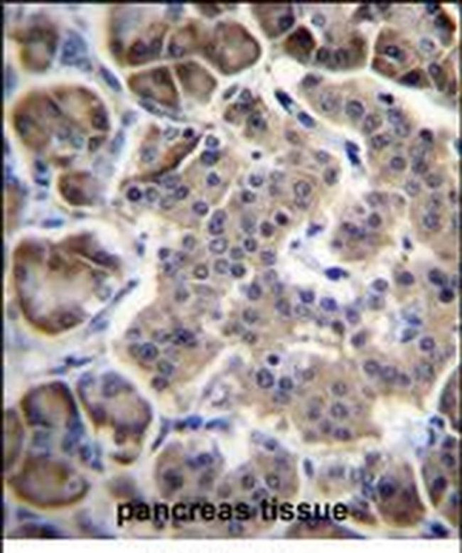 RPL15 Antibody in Immunohistochemistry (Paraffin) (IHC (P))